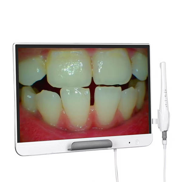 ECRAN AVEC ECRAN 19&quot; AVEC CAMERA INTRABUCCALE SONZ