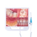 ECRAN AVEC CAMERA INTRABUCCALE SONZ CAM17